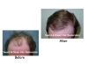 Sword And Dauer Hair Restoration