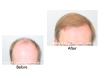 Marc Dauer,MD Hair Restoration