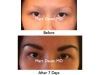 Eyelash and eyebrow implants